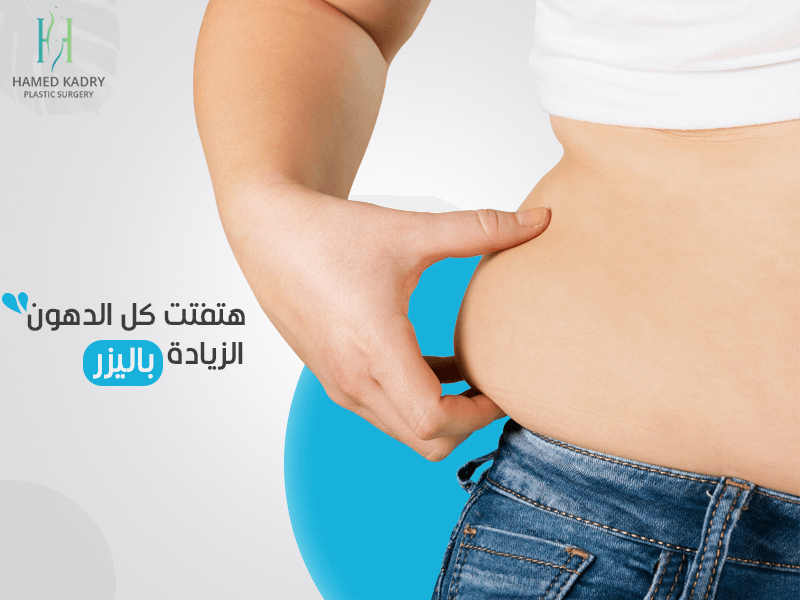  معلومات حول شفط الدهون بالليزر البارد في مصر