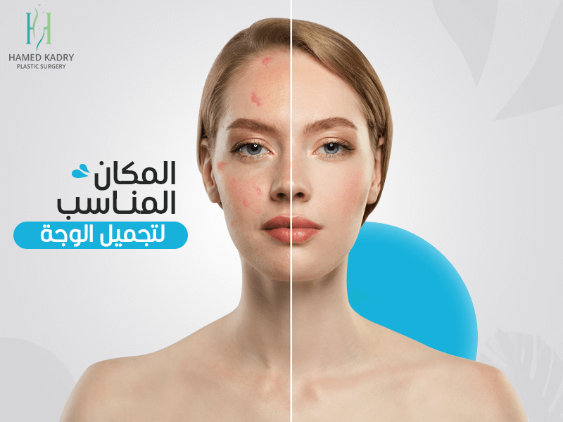 أسعار عمليات تجميل الوجه في مصر